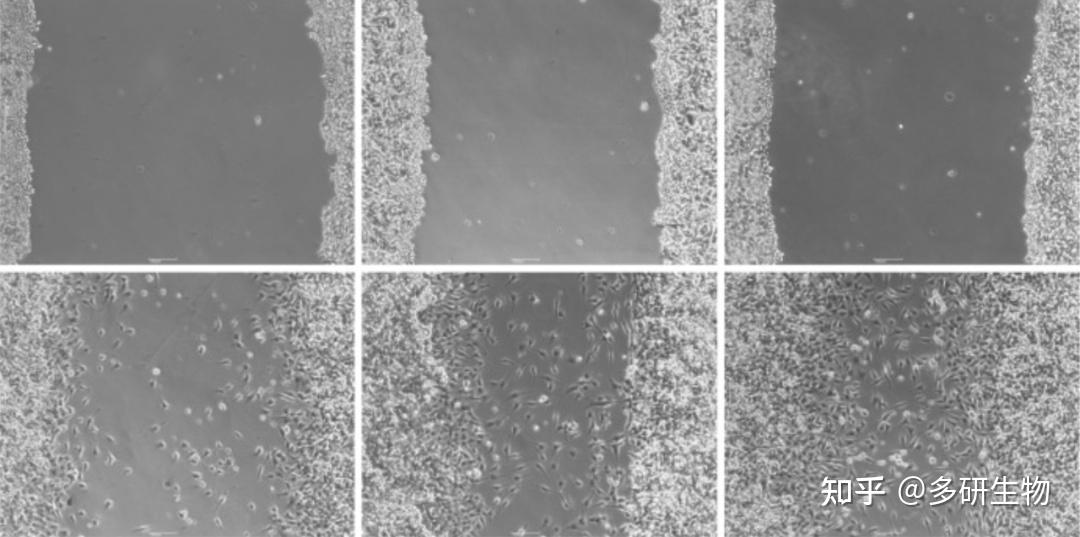 细胞迁移全攻略：细胞划痕、Transwell实验深度解析 - 知乎