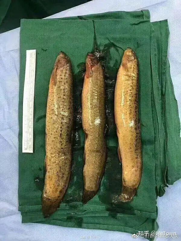 到底有多少东西被人塞进了菊花里?