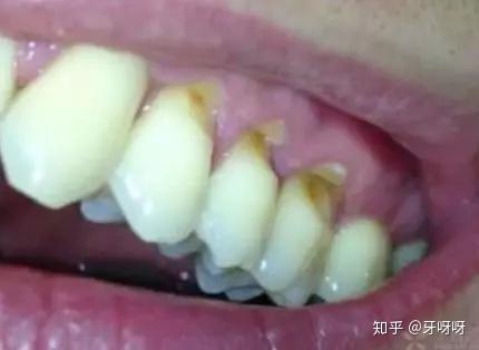 v2-b771b37fd158d3804a8c316be62f9e99_r.jpg