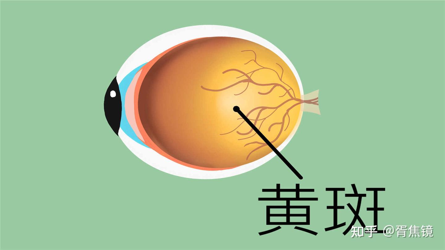 什么是黄斑病变？ - 知乎