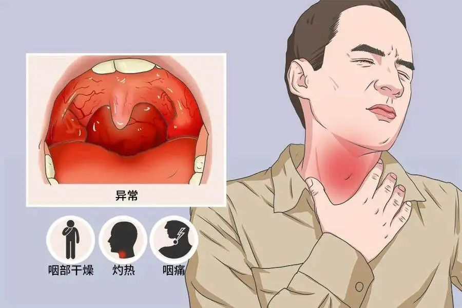 最近全国上下有多少朋友出现这种症状?