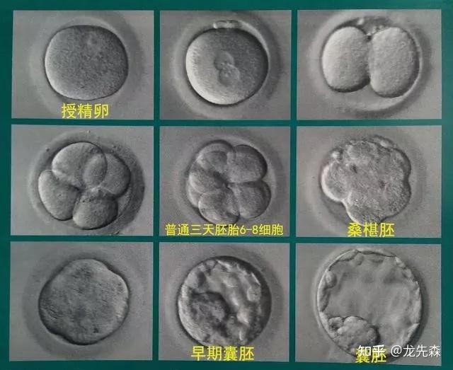 你是否需要養囊囊胚的質量如何評判和對比關於囊胚移植那些事