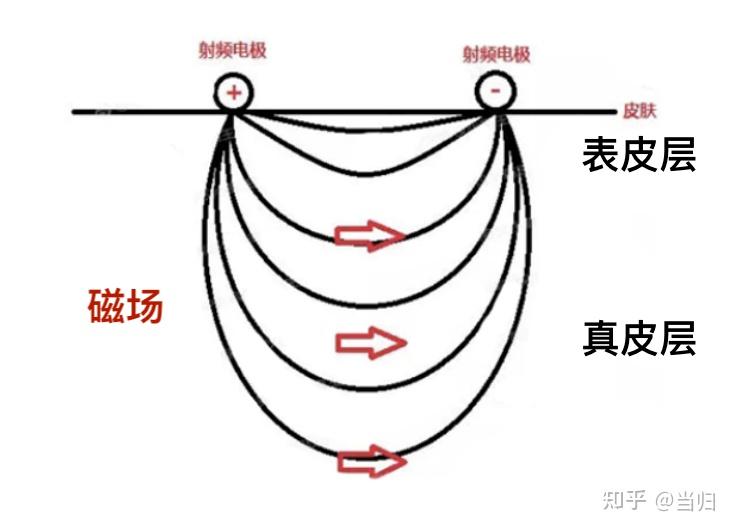 一,家用射频美容符合医学原理,早已被全球权威机构认可二,挑选射频