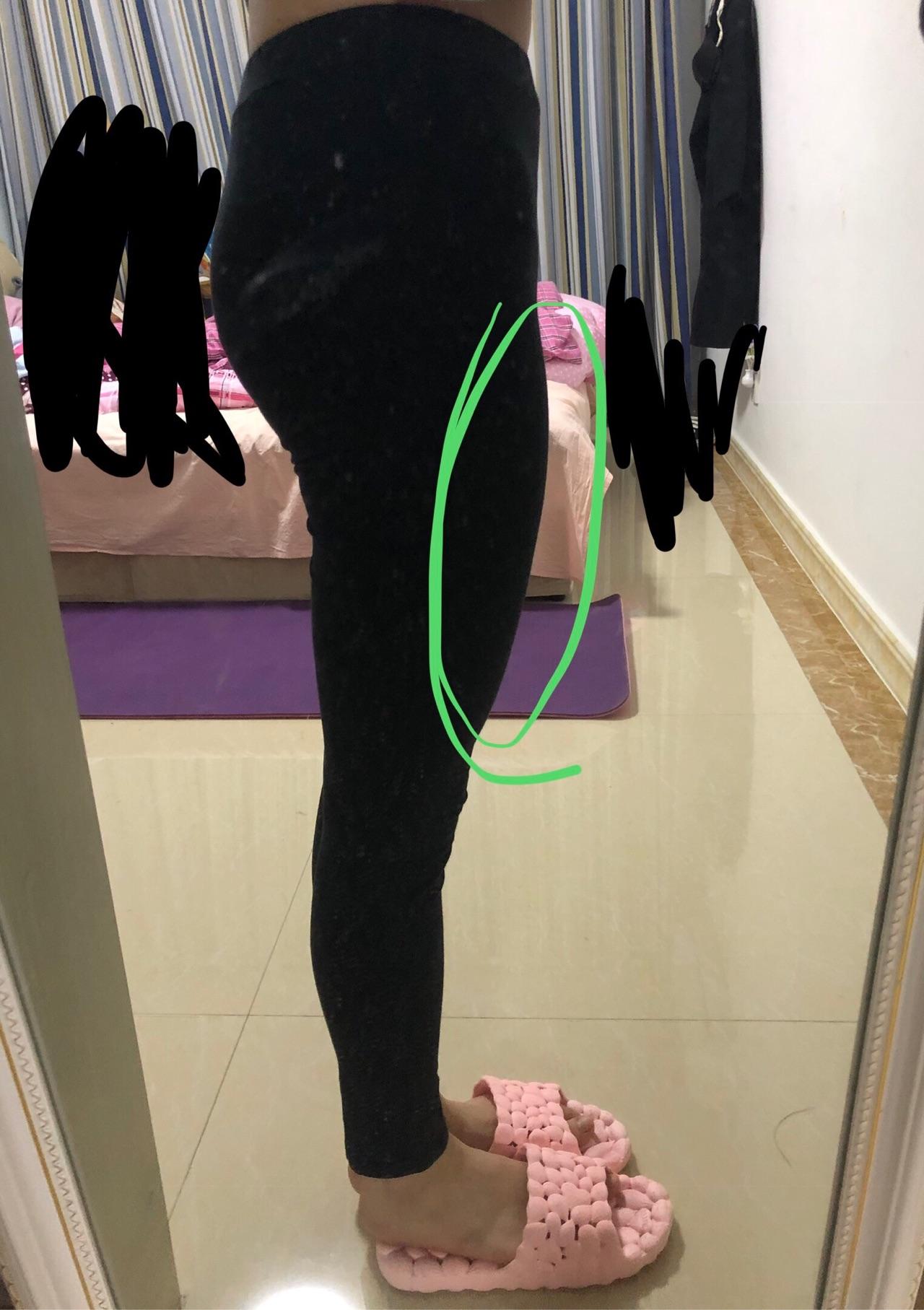 超级严重的梨形身材大腿前侧突出怎么办