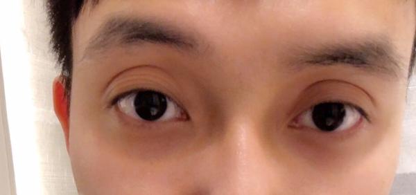 眼窝深是怎样一种体验?