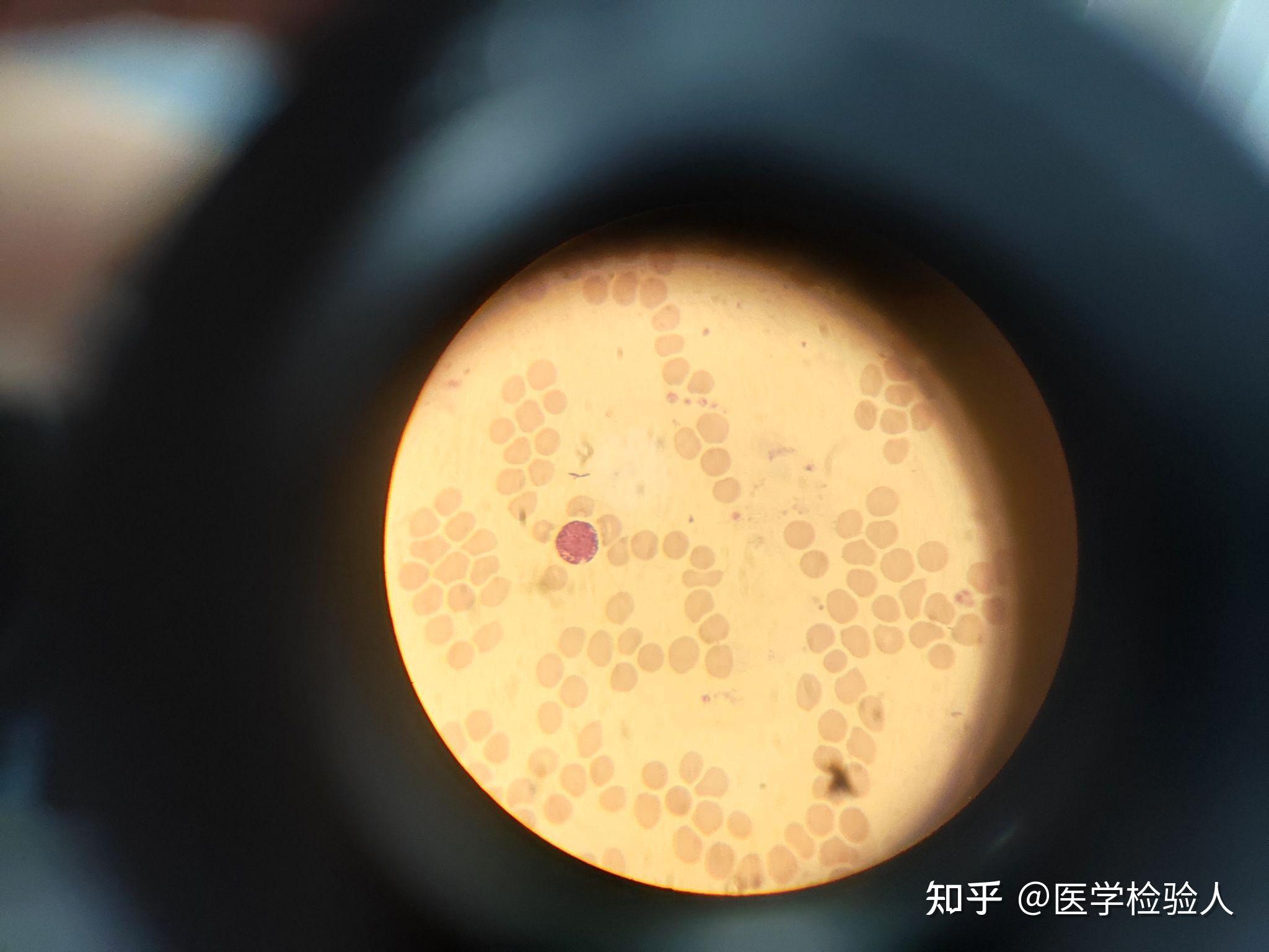 嗜酸性粒细胞和嗜碱性粒细胞
