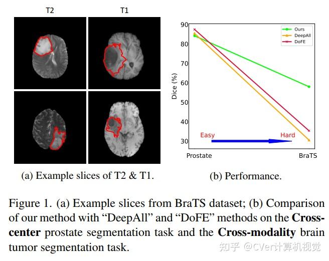 CVPR 2022 南大提出：通过风格增强和双归一化进行跨模态医学图像分割 知乎