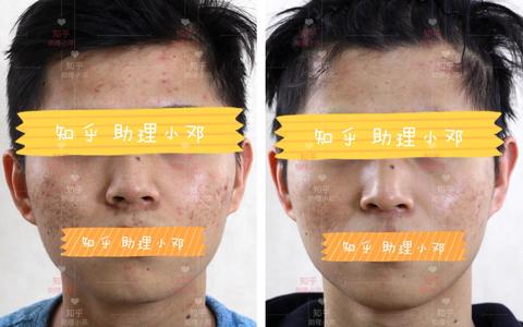 图标