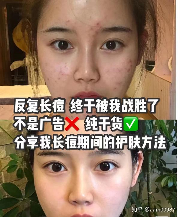 高效增粉不踩坑的实战指南