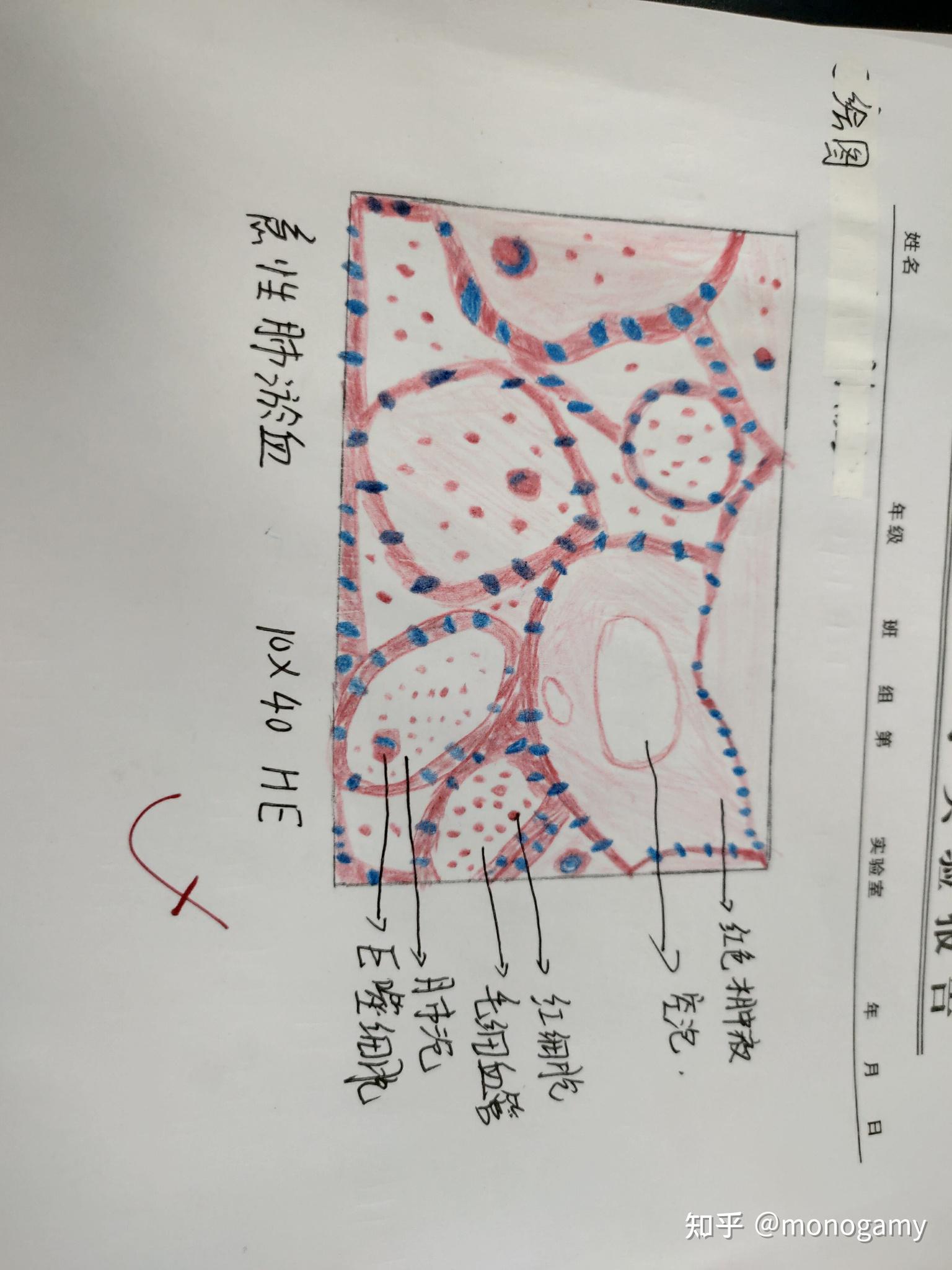 肺组织切片红蓝铅笔图图片