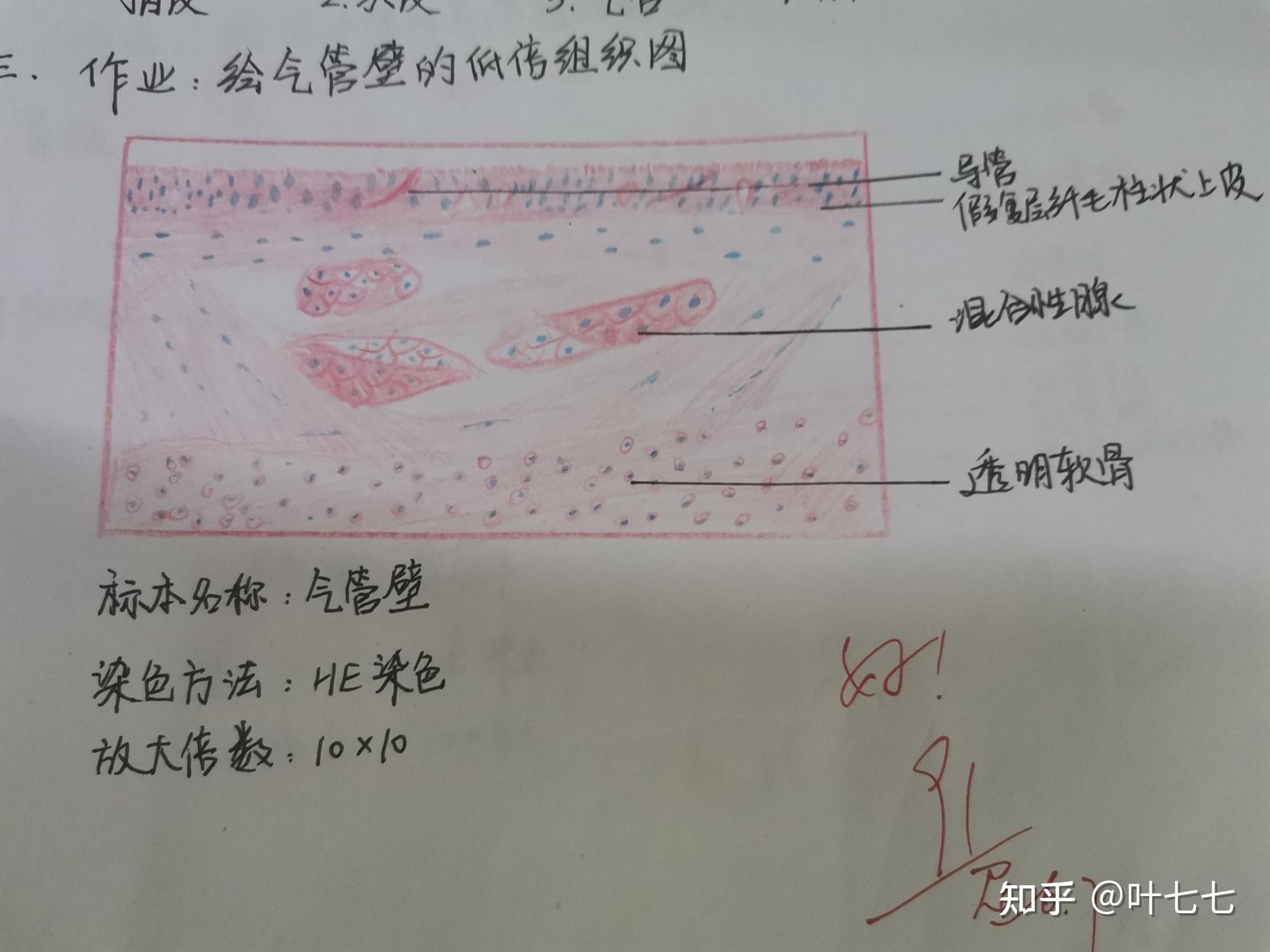 次级卵泡红蓝铅笔构图图片