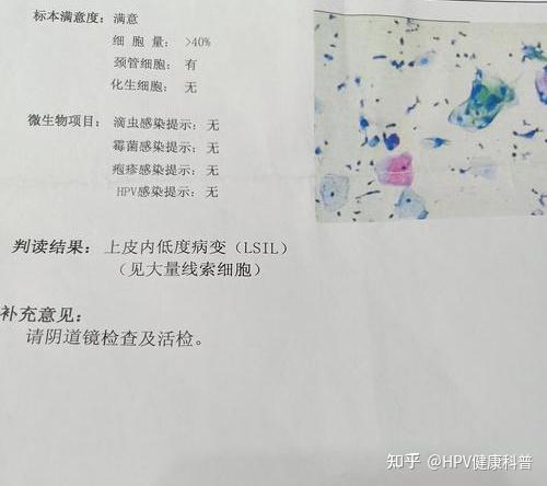 一,为什么要进行tct检查?