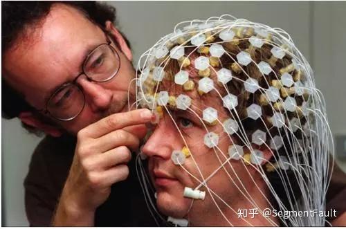 中国脑控活体实验图片