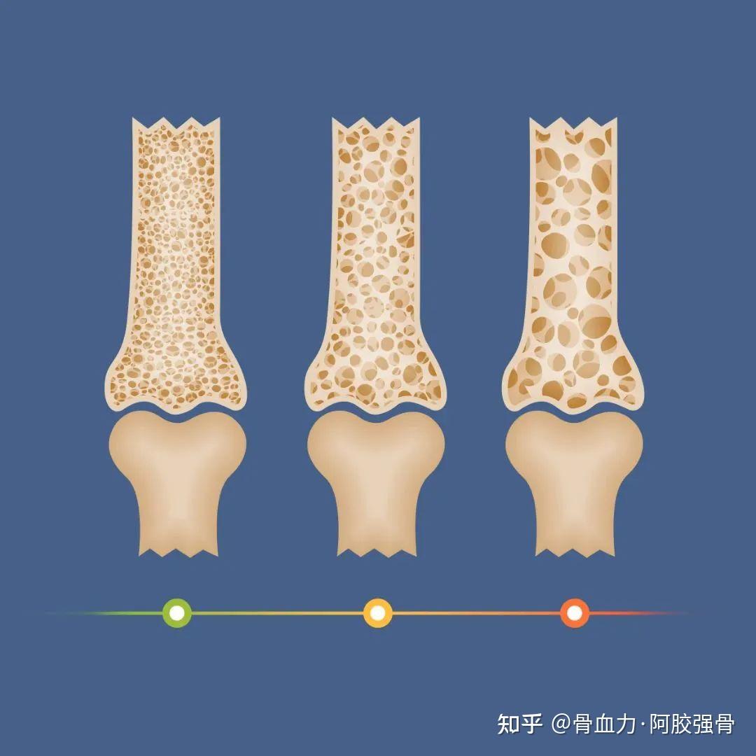 科普小课堂第8期——骨头为什么像花瓶一样脆弱? - 知乎