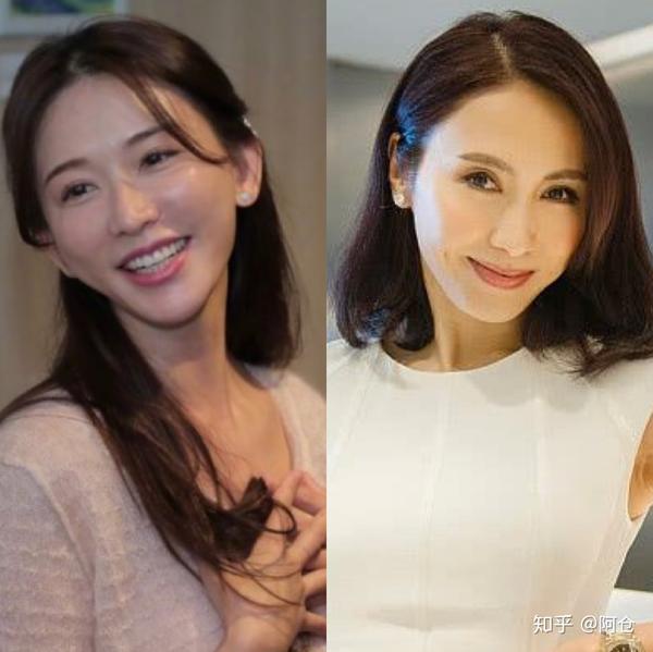 医美之抗衰老女明星为什么不老热玛吉超声刀还是线雕填充