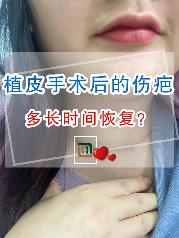 植皮手术后的伤疤多长时间恢复？ - 知乎