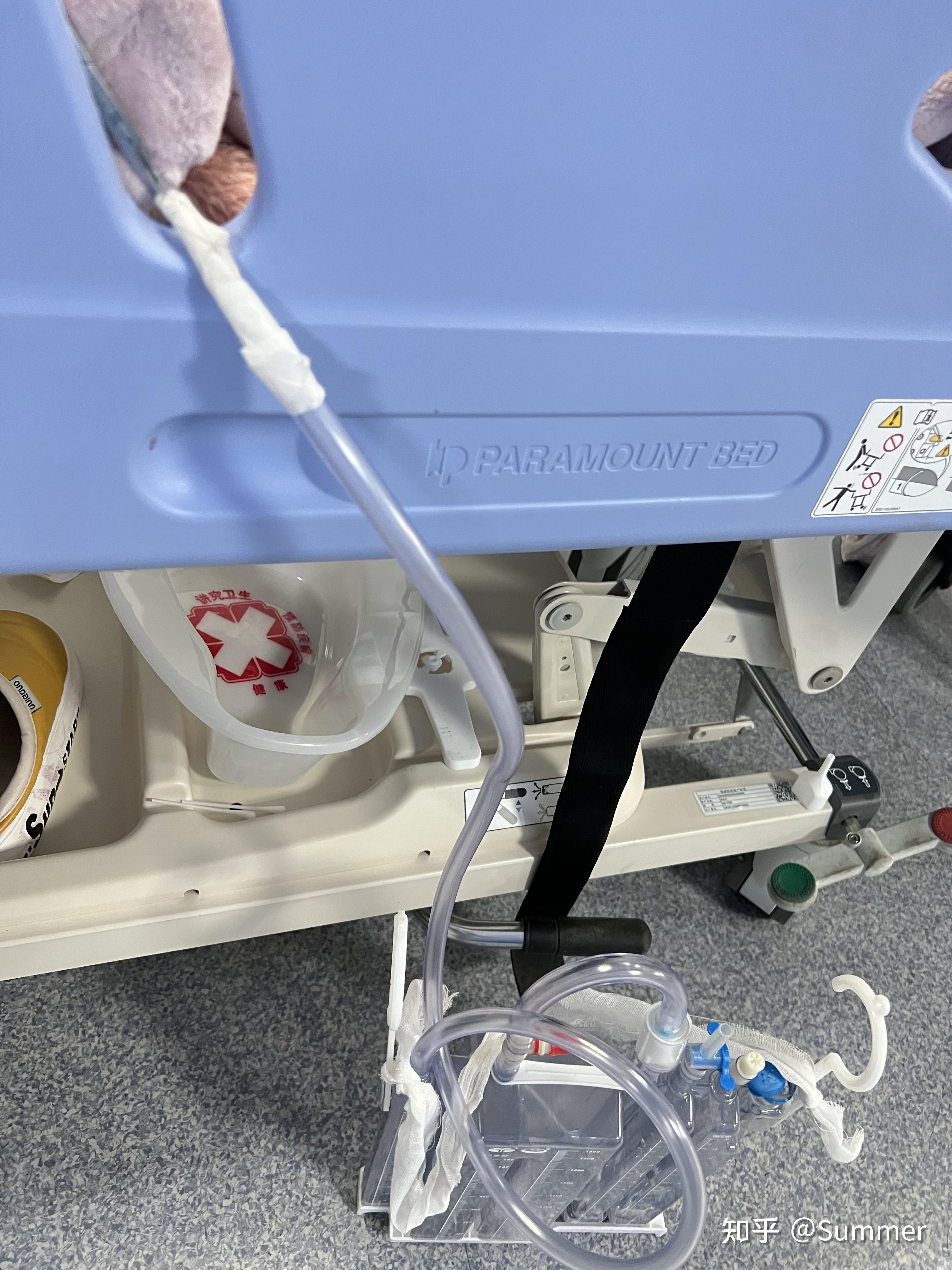 20211129气胸肺大疱切除术   散记