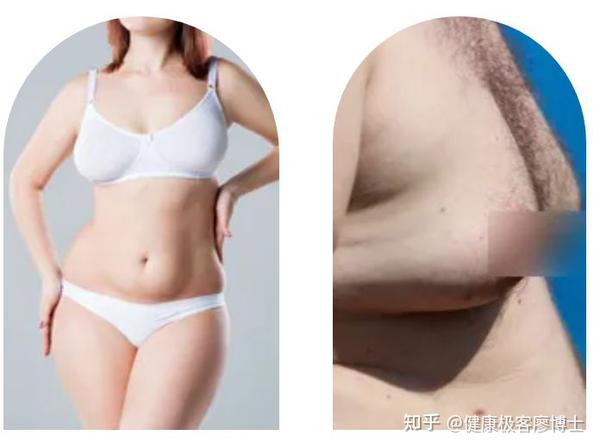 下半身肥胖 脂肪增加在臀部 大腿 当心你的雌激素过盛 知乎