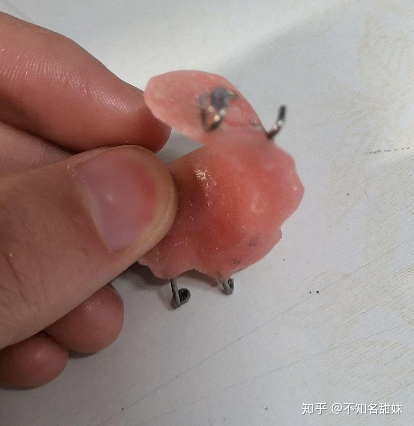 牙齿矫正记录 - 知乎