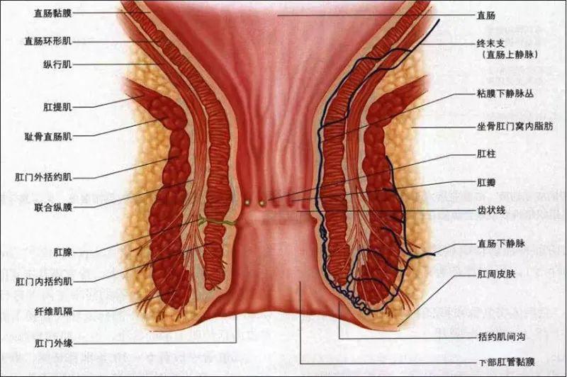 括约肌间肛瘘图片