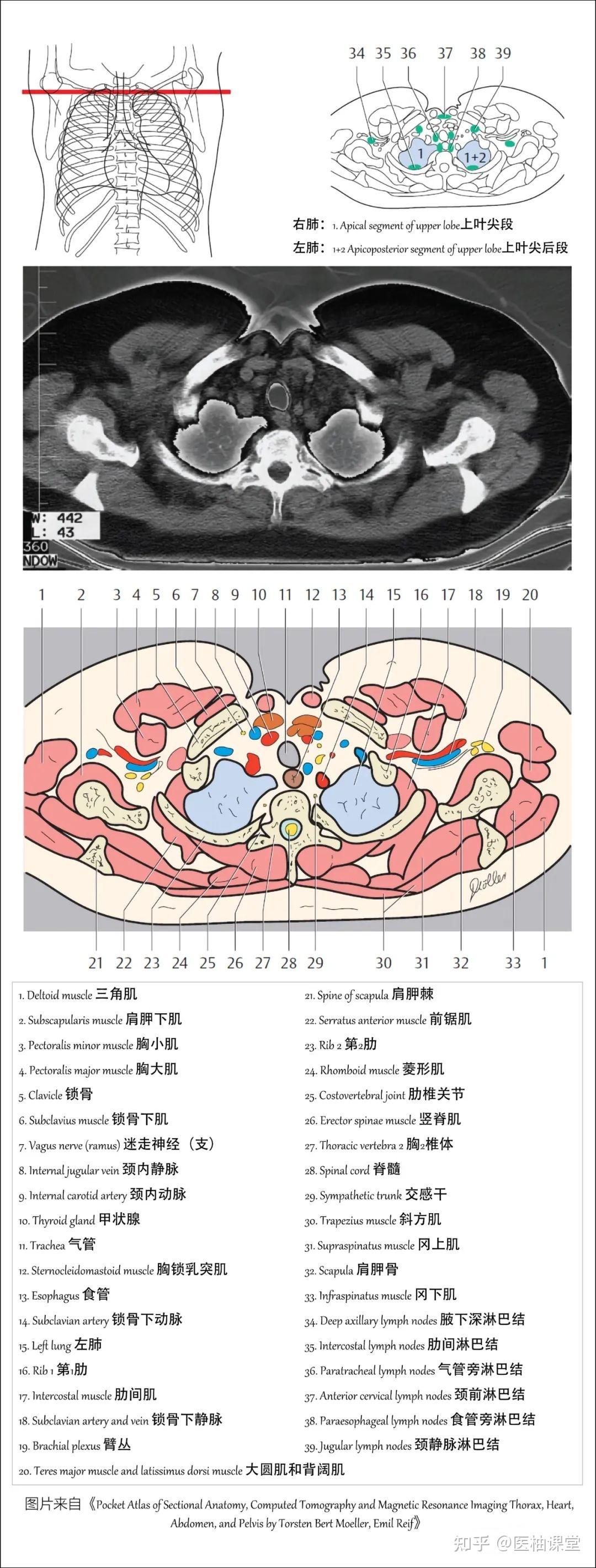 右肺叶间裂示意图图片