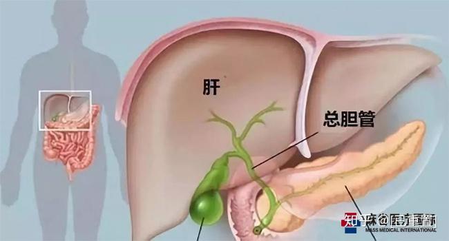 体检查出胆囊息肉怎么办?身体的这些信号要警惕