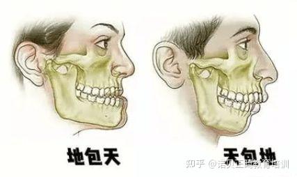 “地包天”的最佳矫正年龄 - 知乎