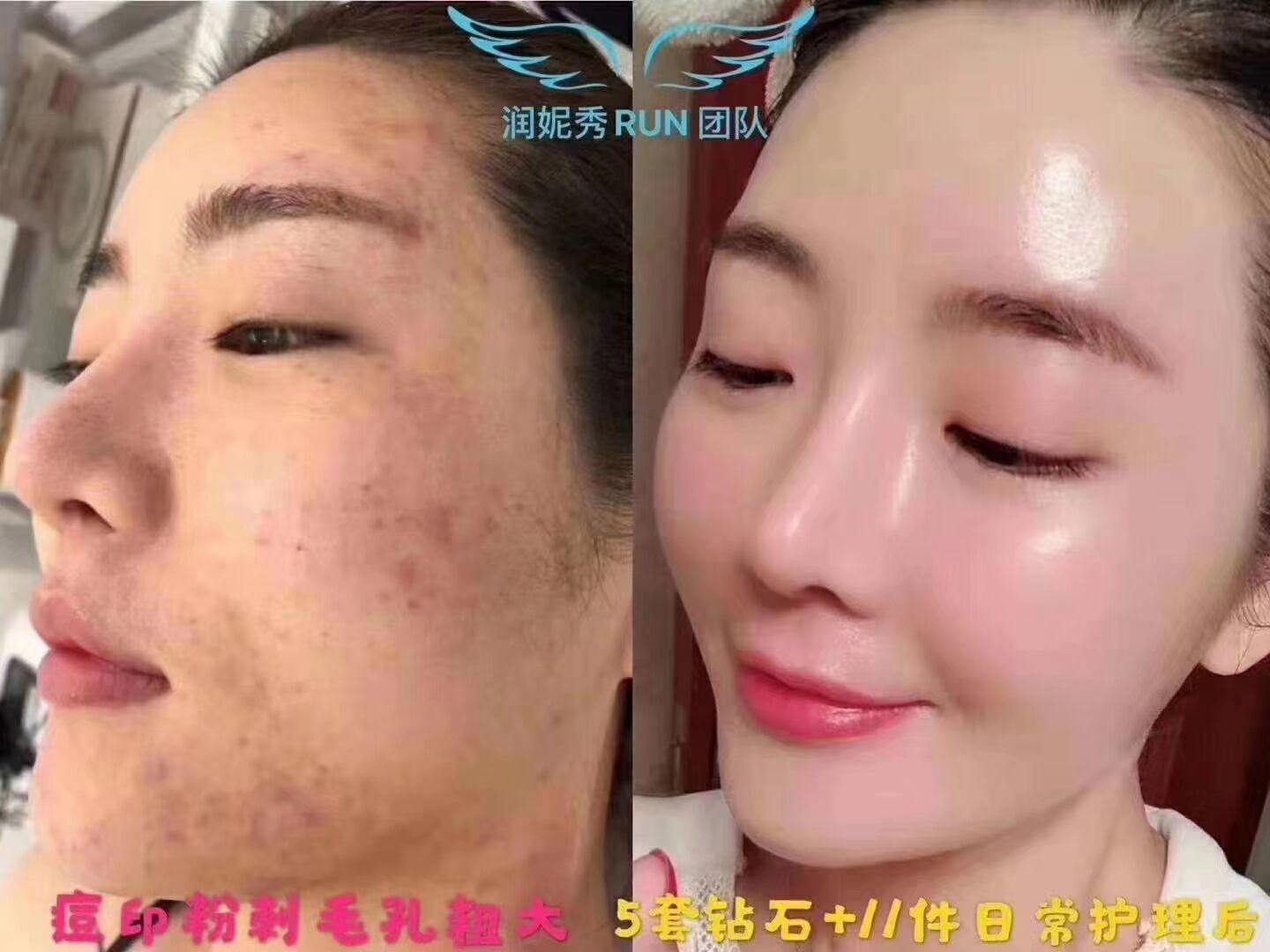 现在朋友圈流行的润妮秀（rene—cell）是什么？ - 知乎