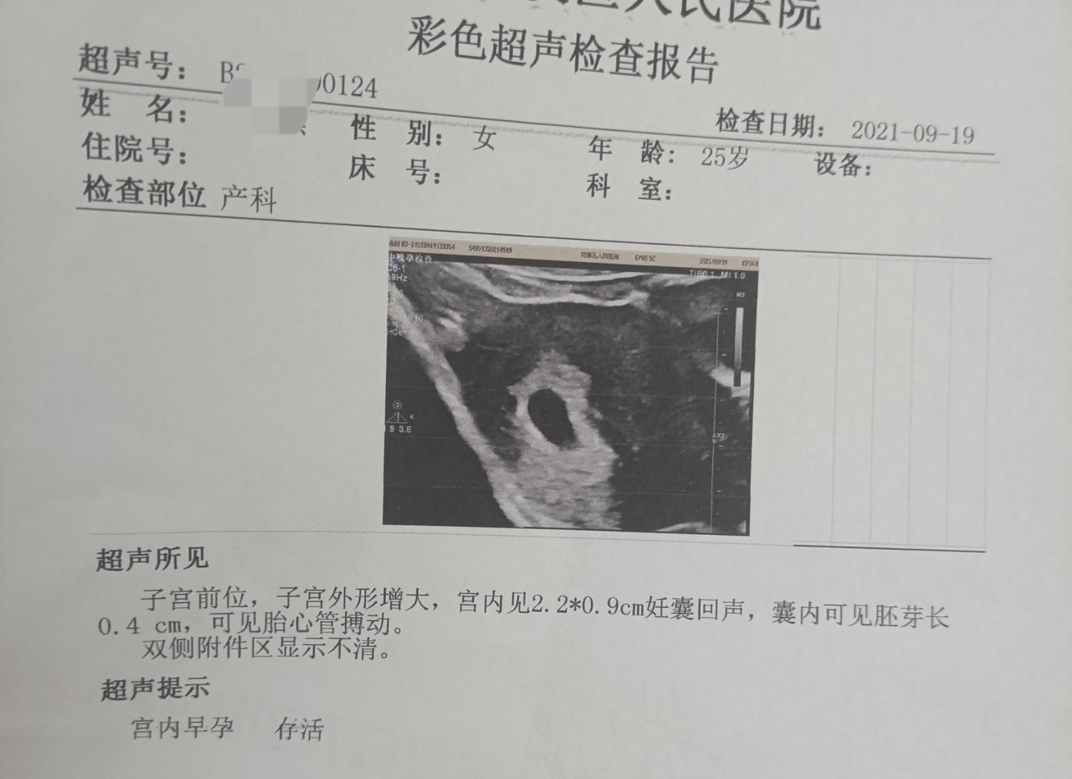 习惯性流产再次怀孕饮食需要注意什么 - 知乎