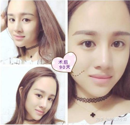 如何变成小巧高鼻梁 v2-bafe00afaad064528999a1a5e69e87fd_r.jpg