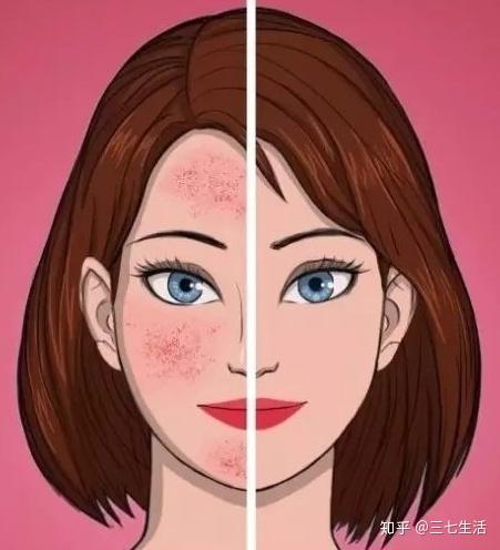 壹知肤皮肤提前衰老因为你做了这一点