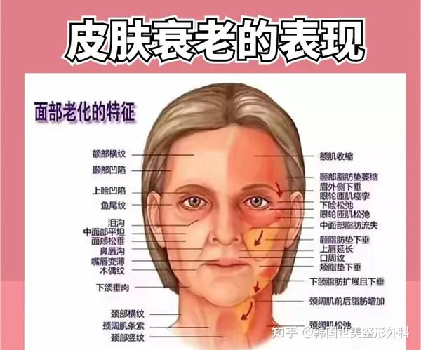 了解清楚皮肤衰老的表现后就知道怎么去合理抗衰 - 知乎