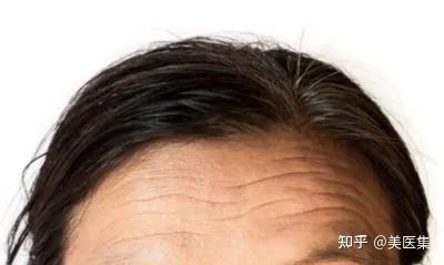 额头有纹的人注意了，你的运势正隐藏其中！ - 知乎