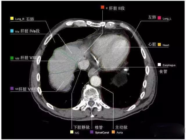 外科医生阅片能力:看完它,再也没有看不懂的腹部CT - 知乎
