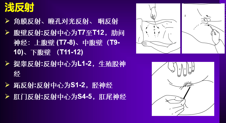 咽反射检查方法图片