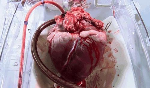 胸腔器官动态ct显示