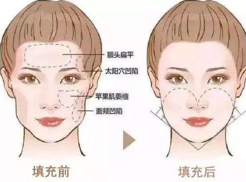 v2-bb6b3709f8e9e4afe7473f4d3b0c8251_1440w.jpg?source=172ae18b