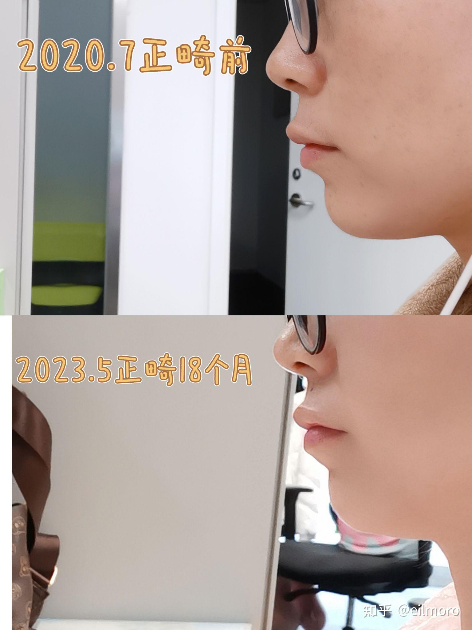 关于北大口腔医院、顺义区号贩子挂号电话,欢迎咨询的信息