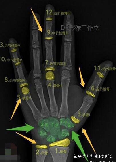 腕骨骨化中心图片