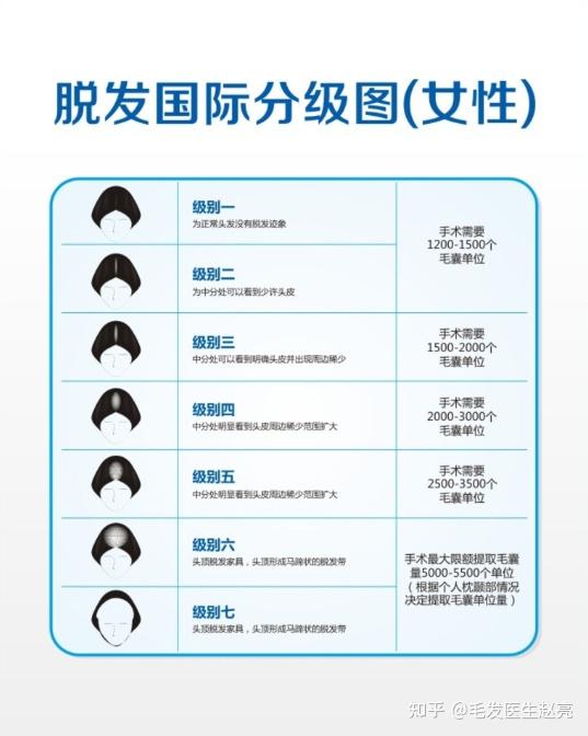 脱发也分人 男性比女性更容易脱发 知乎 脱发也分人 男性比女性更容易脱发 知乎