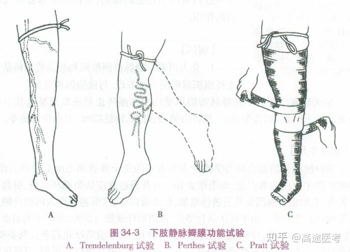 pratt试验图片