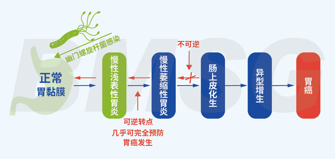 感染了幽门螺杆菌就会得胃癌吗?看看医生怎么说!