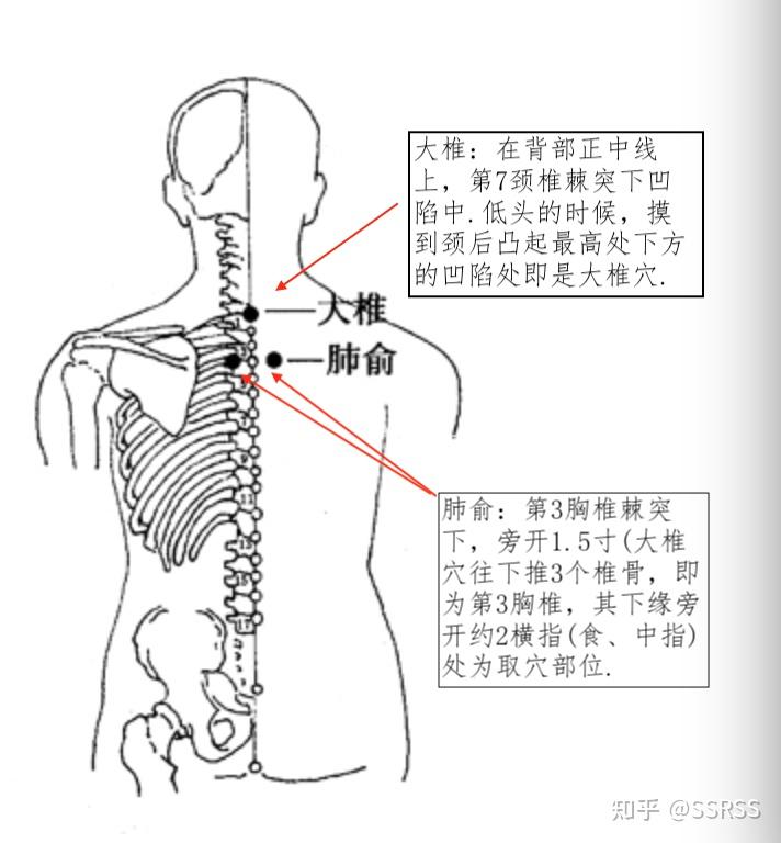 风寒感冒怎么艾灸?