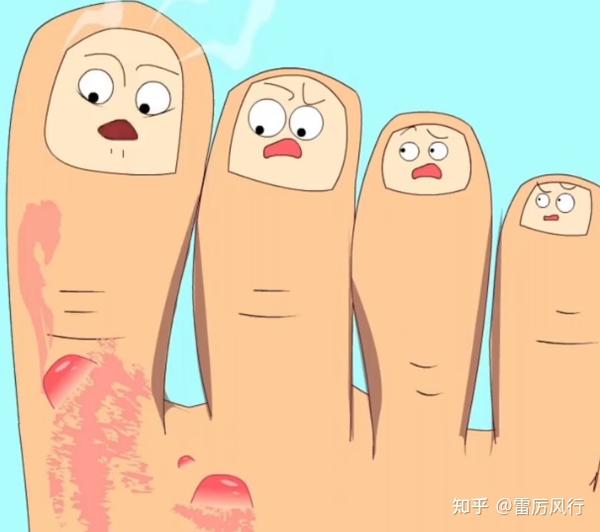 如何才能根治脚气?