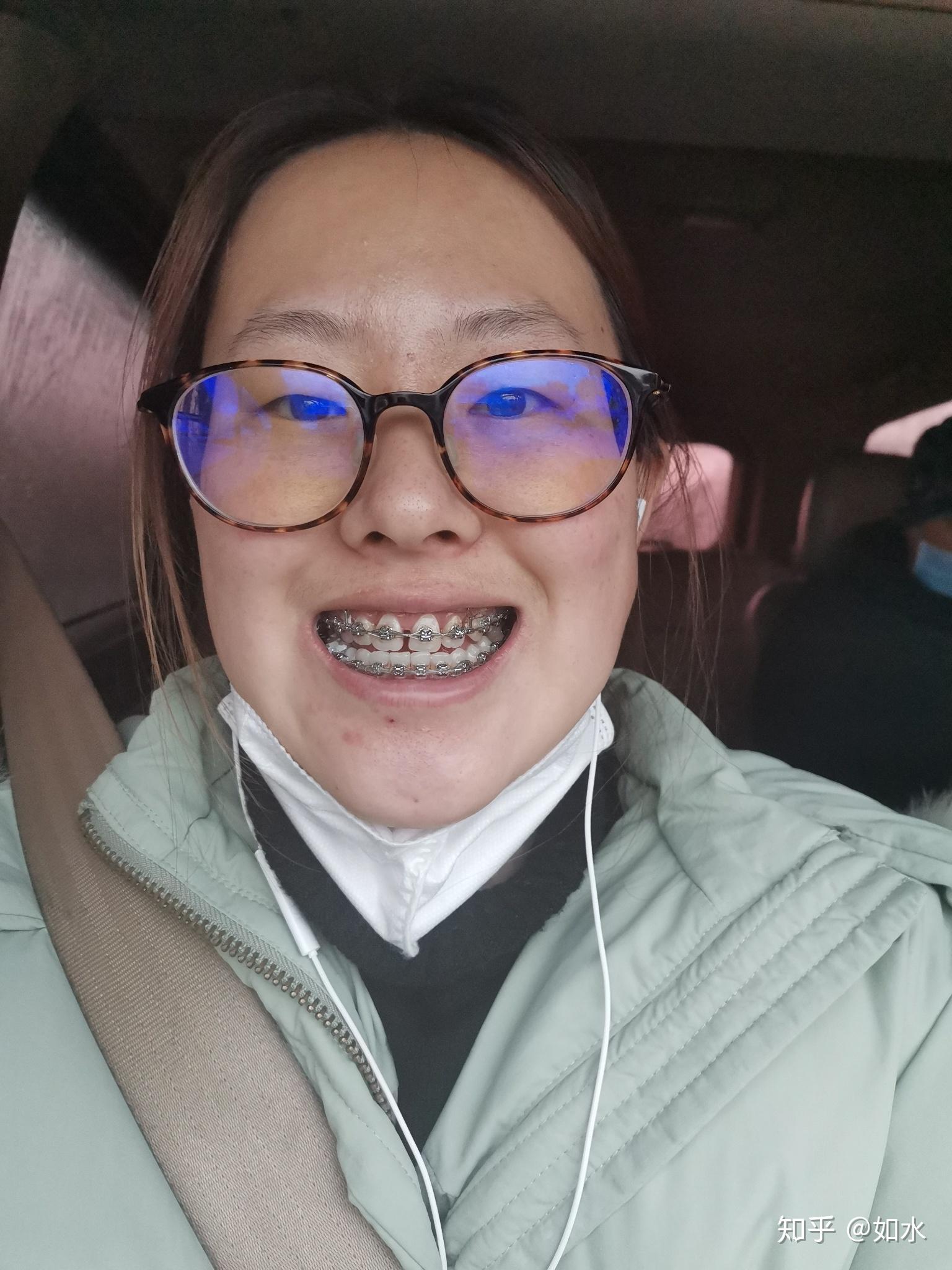 正畸2018926第一次去看牙花费