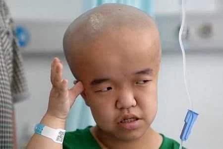 别让你的孩子成为下一个大头娃娃萌童季