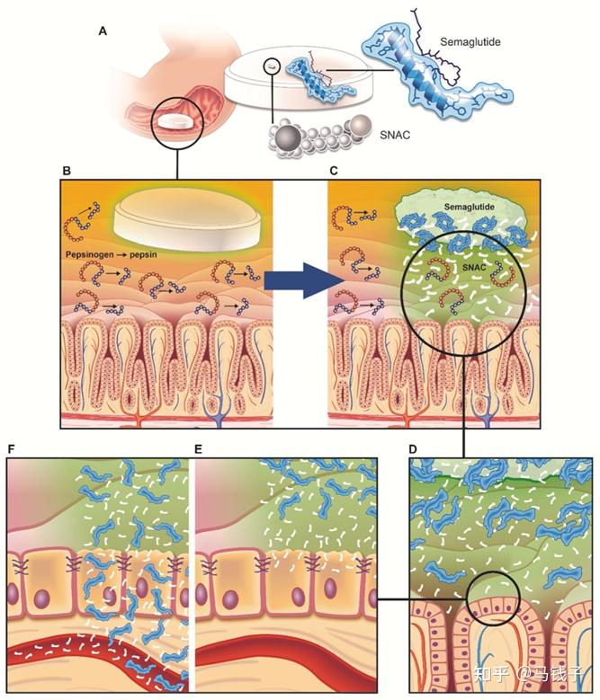 创造奇迹的神药——口服司美格鲁肽递送技术 - 知乎