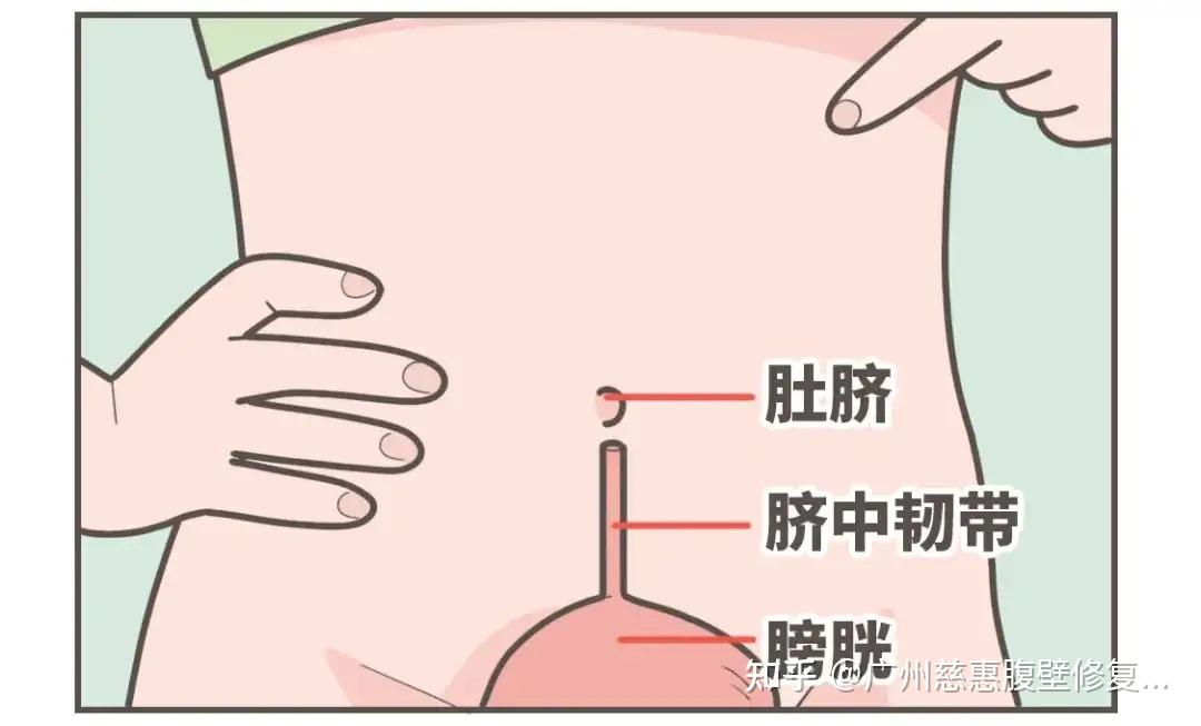 腹リョナ图片