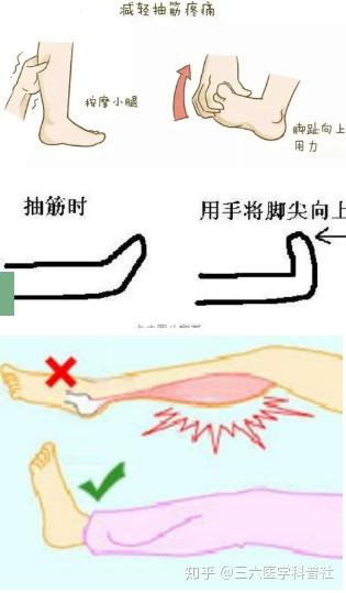 关于小腿抽筋的二三事