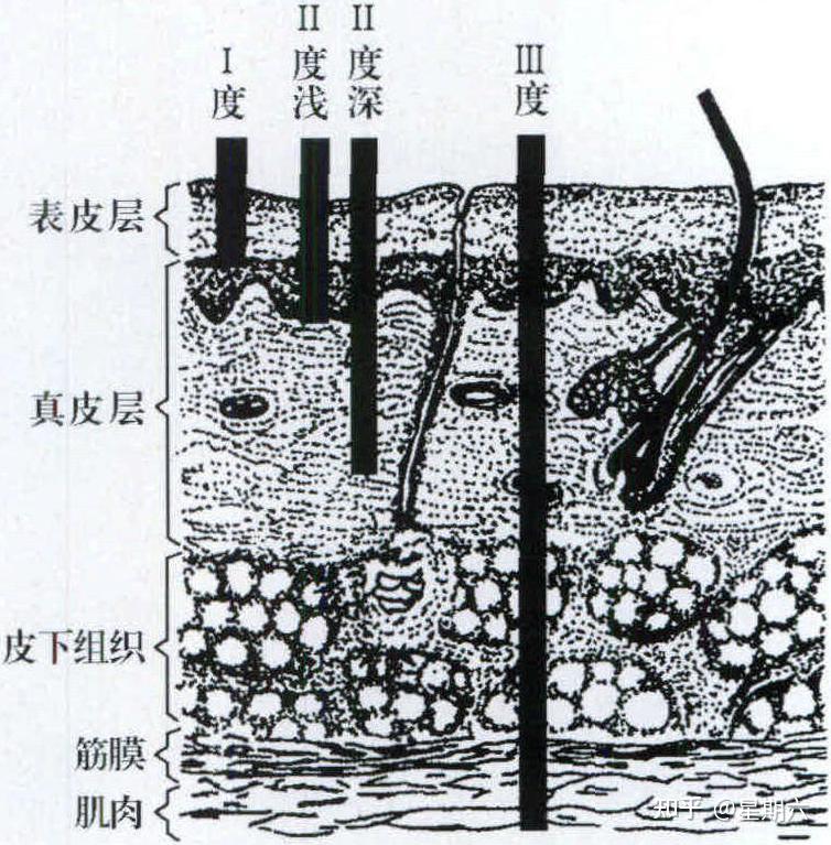 自考本科《外科护理学》考点总结 第七章 - 知乎